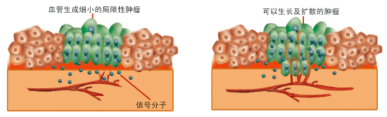 增生性瘢痕与血管内皮生长因子相关性的研究进展