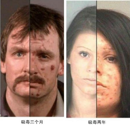 甲卡西酮的危害